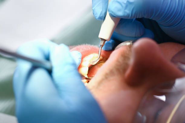 Best Knocked-Out Tooth Emergency  in Santee, SC