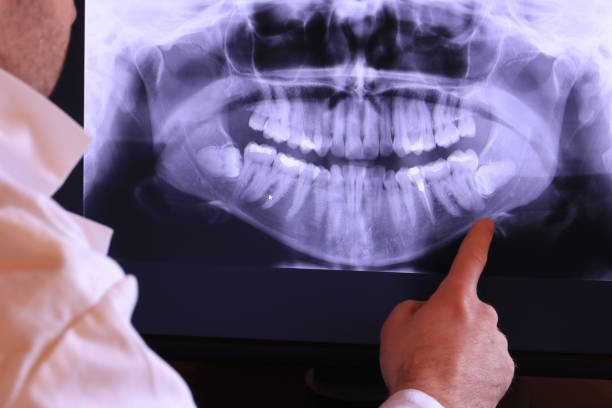 Tooth Infection Emergency Dentist in SC