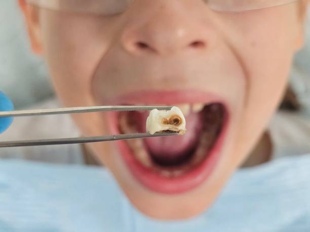 Best Urgent Tooth Repair  in Santee, SC
