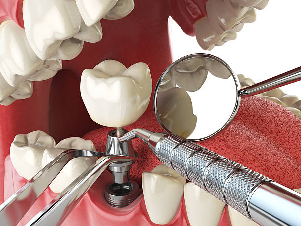 Best Cracked Tooth Emergency Dentist  in Santee, SC
